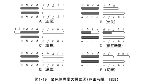 染色体異常の模式図