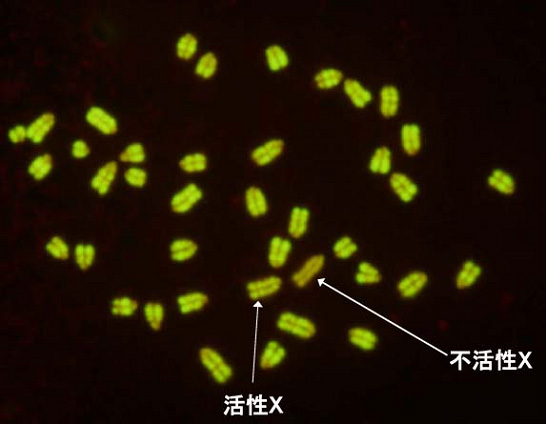 不活性X染色体